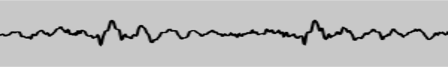 a black oscilloscope line, showing the waveform of an audio signal