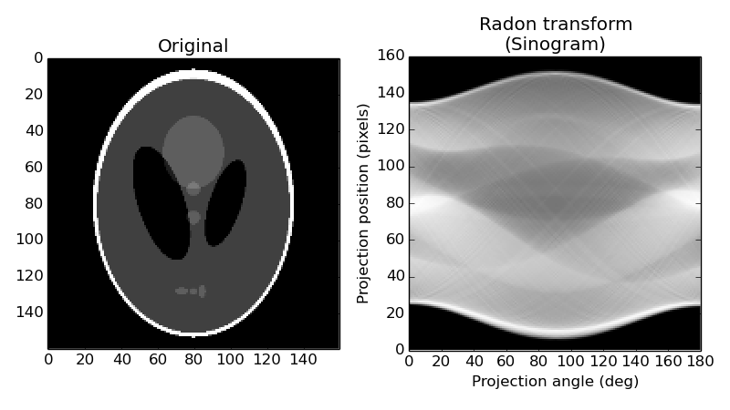 ../../_images/plot_radon_transform_1.png